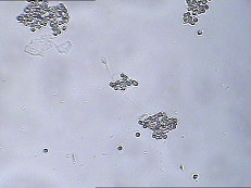 Corredo dell'analisi funzionale dello sperma MARZO di IgA Test Kit IgA Antibody Coating Spermatozoa MARZO